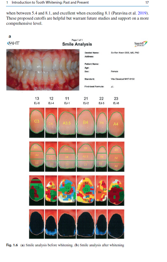 Tooth Whitening: An Evidence-Based Perspective, Second Edition