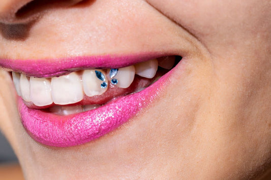 Why Adding Tooth Gems Is a Smart Move for Your Teeth Whitening Business