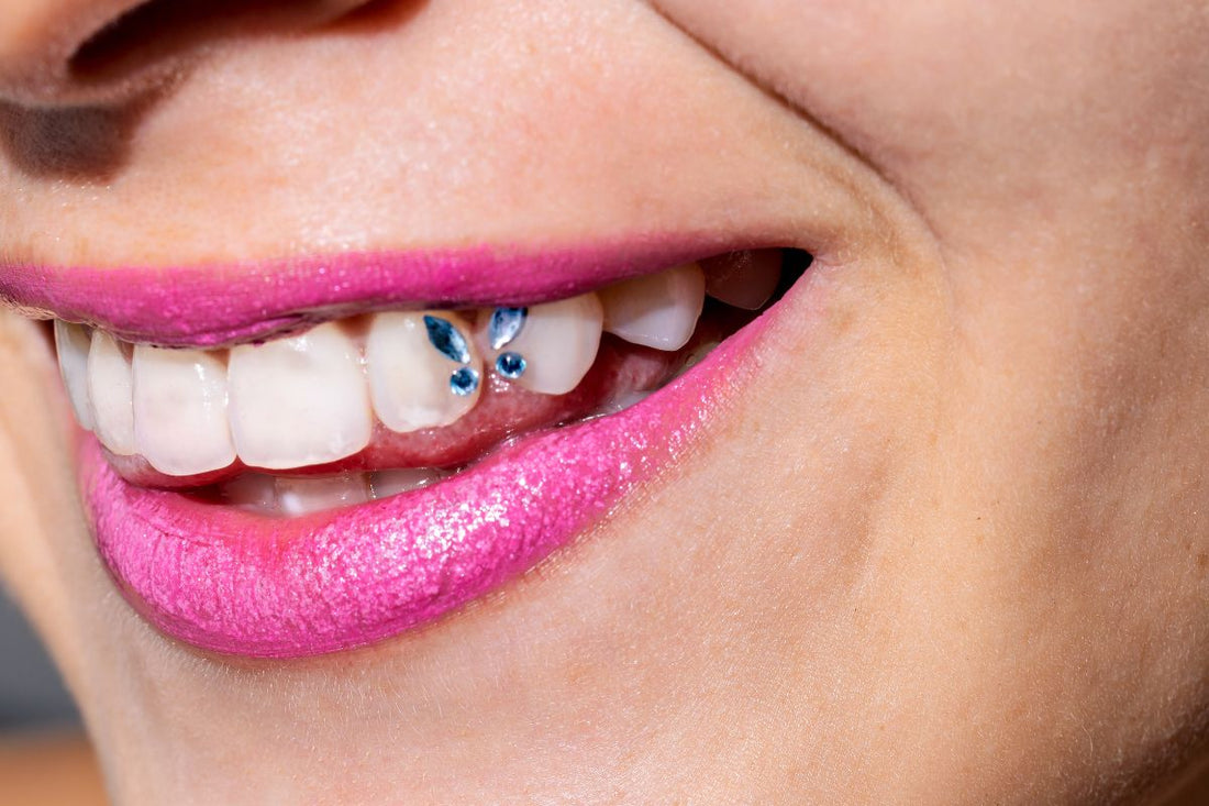 Why Adding Tooth Gems Is a Smart Move for Your Teeth Whitening Business