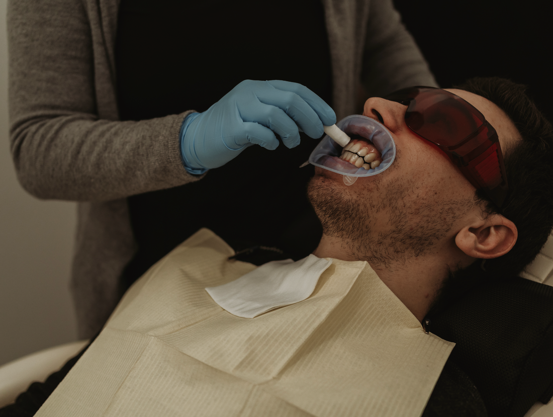 Should I Provide Follow-Up Whitening Visits for My Chairside Clients?
