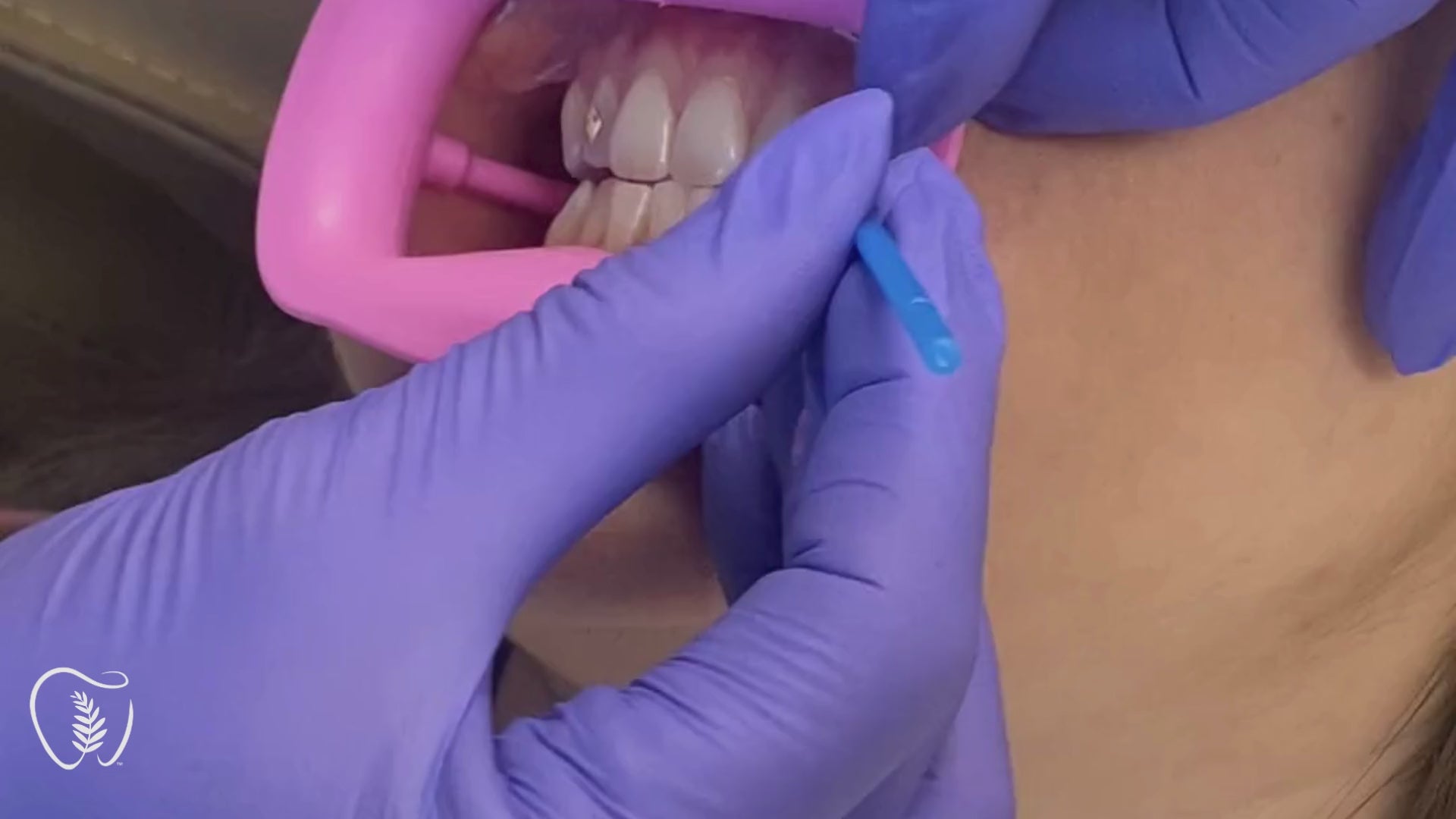 Wax Tip Applicator 